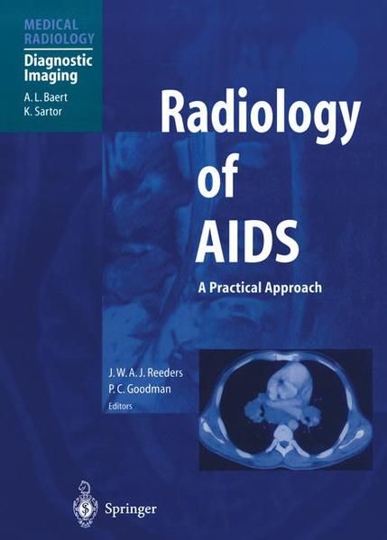 Reeders, J.W.A.J. and P.C. Goodman:  Radiology of AIDS. [Medical Radiology / Diagnostic Imaging]. 