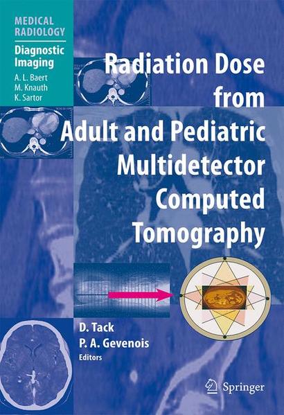 Tack, D. and Pierre Alain Gevenois:  Radiation Dose from Adult and Pediatric Multidetector Computed Tomography. [Medical Radiology]. 