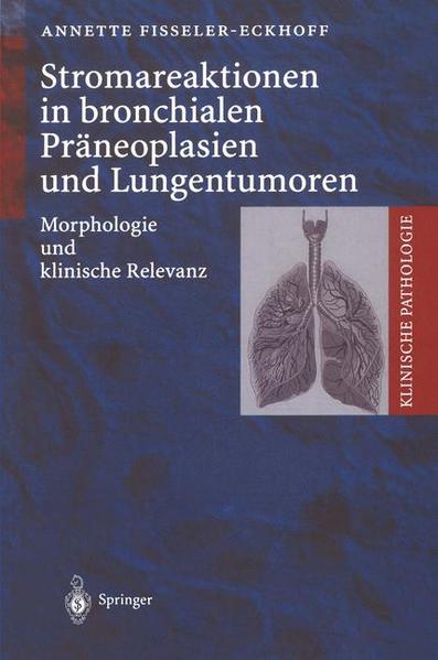 Fisseler-Eckhoff, Annette:  Stromareaktionen in bronchialen Präneoplasien und Lungentumoren. Morphologie und klinische Relevanz. [Klinische Pathologie]. 