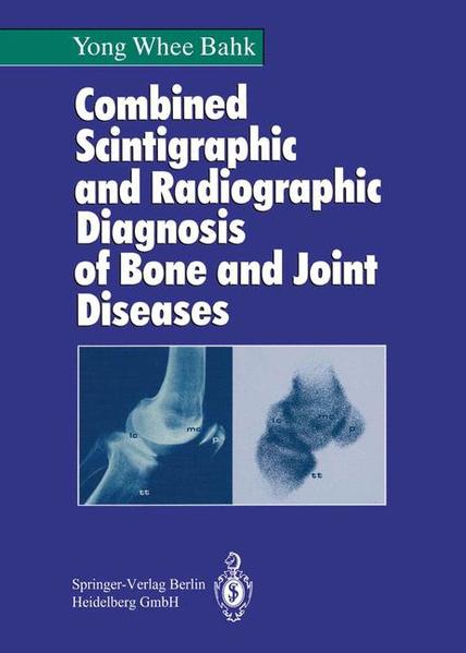 Pak, Yong-hwi:  Combined scintigraphic and radiographic diagnosis of bone and joint diseases. 